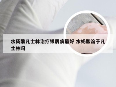 水杨酸凡士林治疗银屑病最好 水杨酸溶于凡士林吗