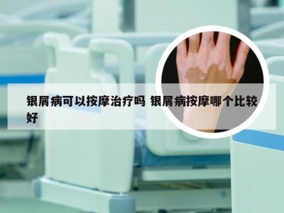 银屑病可以按摩治疗吗 银屑病按摩哪个比较好