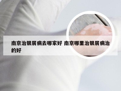 南京治银屑病去哪家好 南京哪里治银屑病治的好