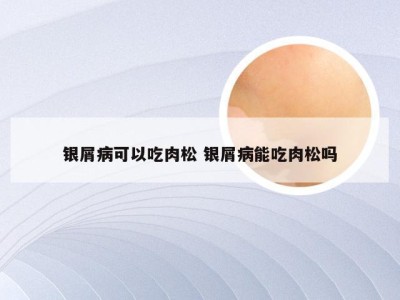 银屑病可以吃肉松 银屑病能吃肉松吗