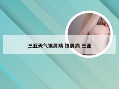 三亚天气银屑病 银屑病 三亚