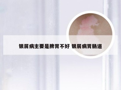 银屑病主要是脾胃不好 银屑病胃肠道