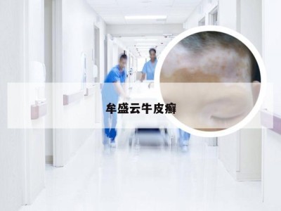 牟盛云牛皮癣