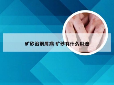 矿砂治银屑病 矿砂有什么用途