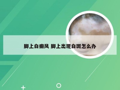 脚上白癫风 脚上出现白斑怎么办