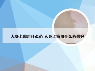 人身上癣用什么药 人身上癣用什么药最好