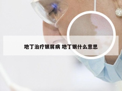 地丁治疗银屑病 地丁银什么意思