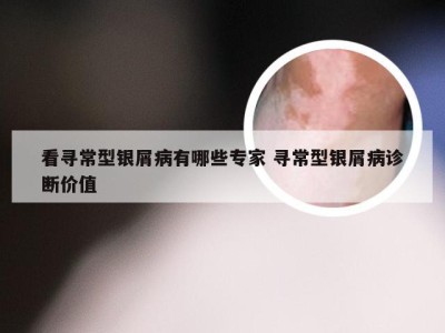 看寻常型银屑病有哪些专家 寻常型银屑病诊断价值