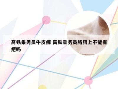高铁乘务员牛皮癣 高铁乘务员胳膊上不能有疤吗