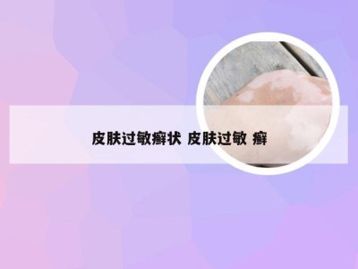 皮肤过敏癣状 皮肤过敏 癣