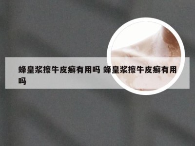 蜂皇浆擦牛皮癣有用吗 蜂皇浆擦牛皮癣有用吗