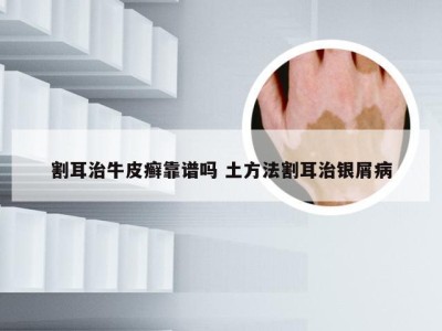 割耳治牛皮癣靠谱吗 土方法割耳治银屑病