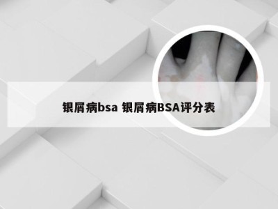 银屑病bsa 银屑病BSA评分表