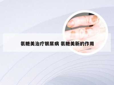 氨糖美治疗银屑病 氨糖美新的作用