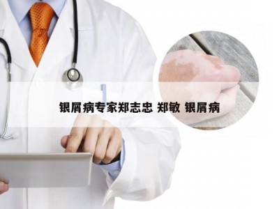 银屑病专家郑志忠 郑敏 银屑病