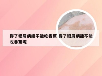 得了银屑病能不能吃香蕉 得了银屑病能不能吃香蕉呢