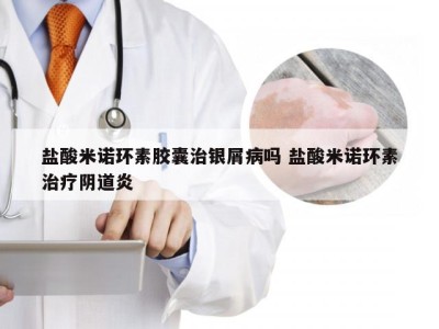 盐酸米诺环素胶囊治银屑病吗 盐酸米诺环素治疗阴道炎