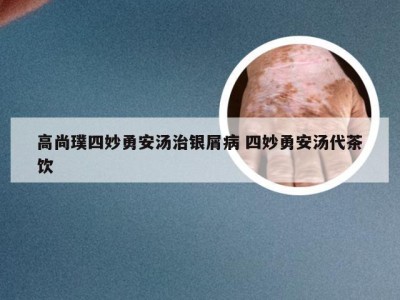 高尚璞四妙勇安汤治银屑病 四妙勇安汤代茶饮
