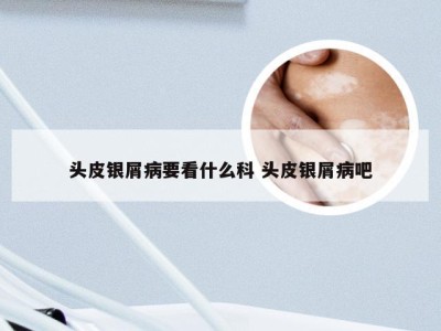 头皮银屑病要看什么科 头皮银屑病吧