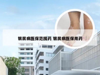 银屑病医保范围药 银屑病医保用药