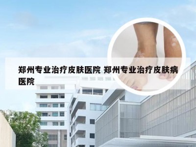 郑州专业治疗皮肤医院 郑州专业治疗皮肤病医院