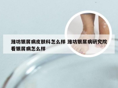 潍坊银屑病皮肤科怎么样 潍坊银屑病研究院看银屑病怎么样