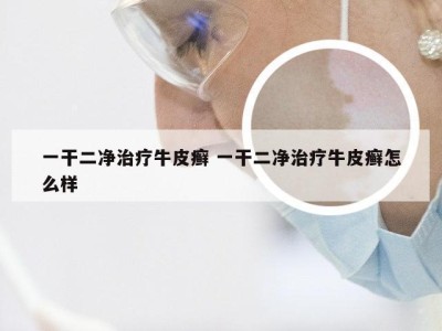 一干二净治疗牛皮癣 一干二净治疗牛皮癣怎么样