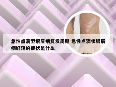 急性点滴型银屑病复发周期 急性点滴状银屑病好转的症状是什么