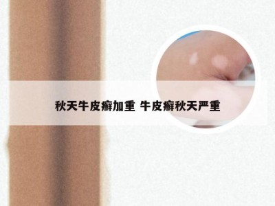 秋天牛皮癣加重 牛皮癣秋天严重