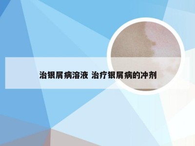 治银屑病溶液 治疗银屑病的冲剂