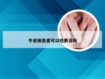 牛皮癣患者可以吃黄豆吗