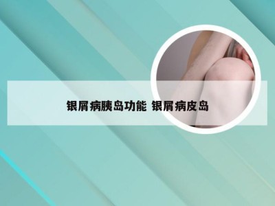 银屑病胰岛功能 银屑病皮岛