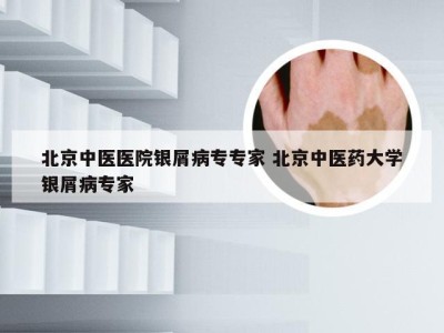 北京中医医院银屑病专专家 北京中医药大学银屑病专家