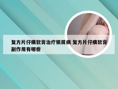 复方片仔癀软膏治疗银屑病 复方片仔癀软膏副作用有哪些
