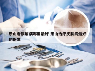 乐山看银屑病哪里最好 乐山治疗皮肤病最好的医生