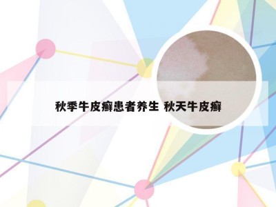 秋季牛皮癣患者养生 秋天牛皮癣