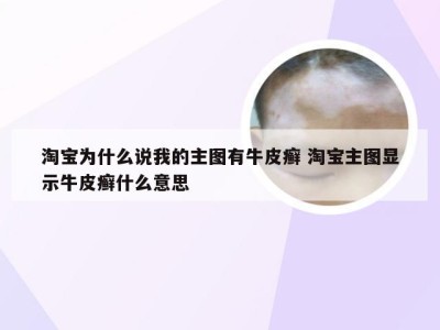 淘宝为什么说我的主图有牛皮癣 淘宝主图显示牛皮癣什么意思