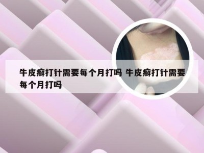牛皮癣打针需要每个月打吗 牛皮癣打针需要每个月打吗