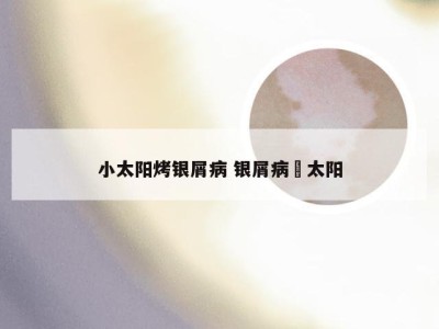 小太阳烤银屑病 银屑病嗮太阳