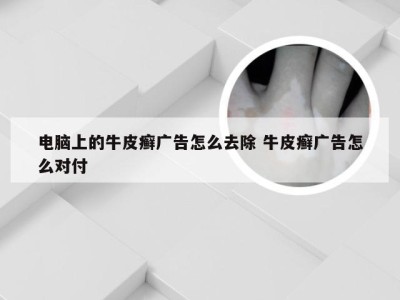 电脑上的牛皮癣广告怎么去除 牛皮癣广告怎么对付