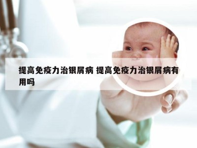 提高免疫力治银屑病 提高免疫力治银屑病有用吗
