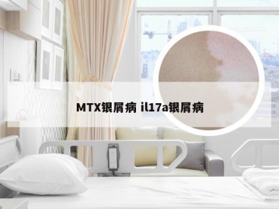 MTX银屑病 il17a银屑病