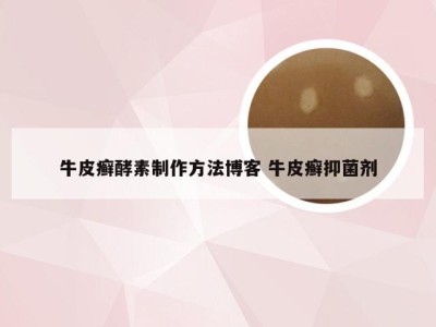 牛皮癣酵素制作方法博客 牛皮癣抑菌剂
