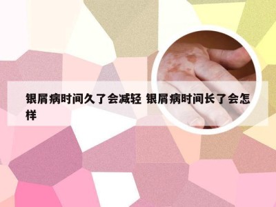 银屑病时间久了会减轻 银屑病时间长了会怎样