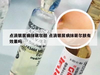 点滴银屑病抹萌尔肤 点滴银屑病抹萌尔肤有效果吗