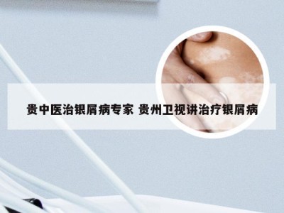 贵中医治银屑病专家 贵州卫视讲治疗银屑病
