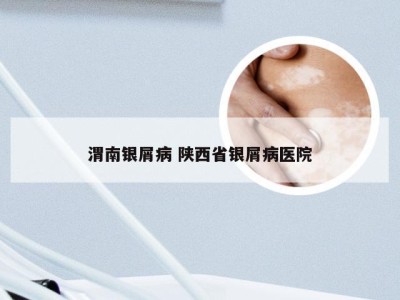渭南银屑病 陕西省银屑病医院