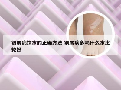 银屑病饮水的正确方法 银屑病多喝什么水比较好