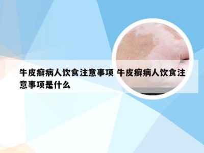 牛皮癣病人饮食注意事项 牛皮癣病人饮食注意事项是什么