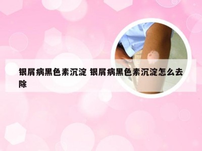 银屑病黑色素沉淀 银屑病黑色素沉淀怎么去除